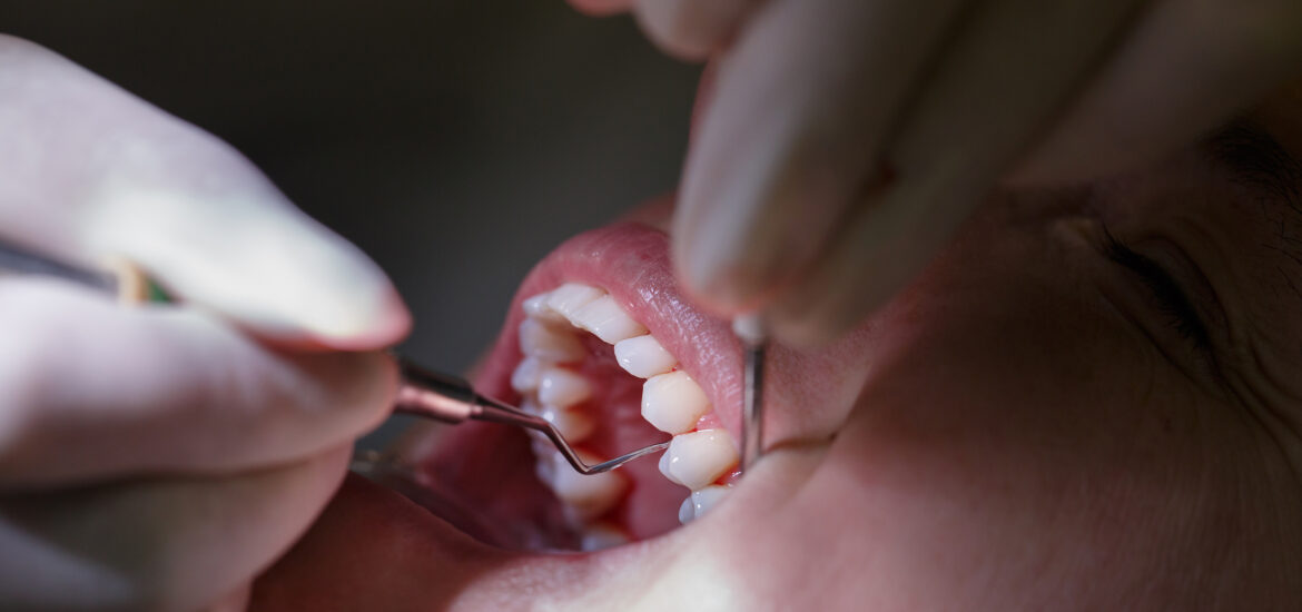 Patient at dentists office, getting receding gum treatment