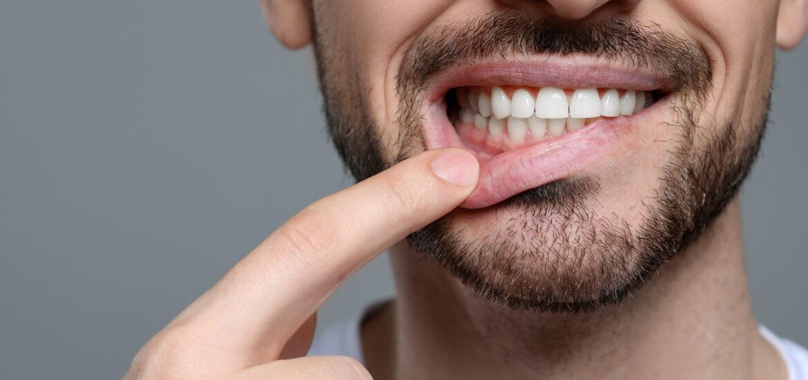 Man showing healthy gums on gray background, closeup