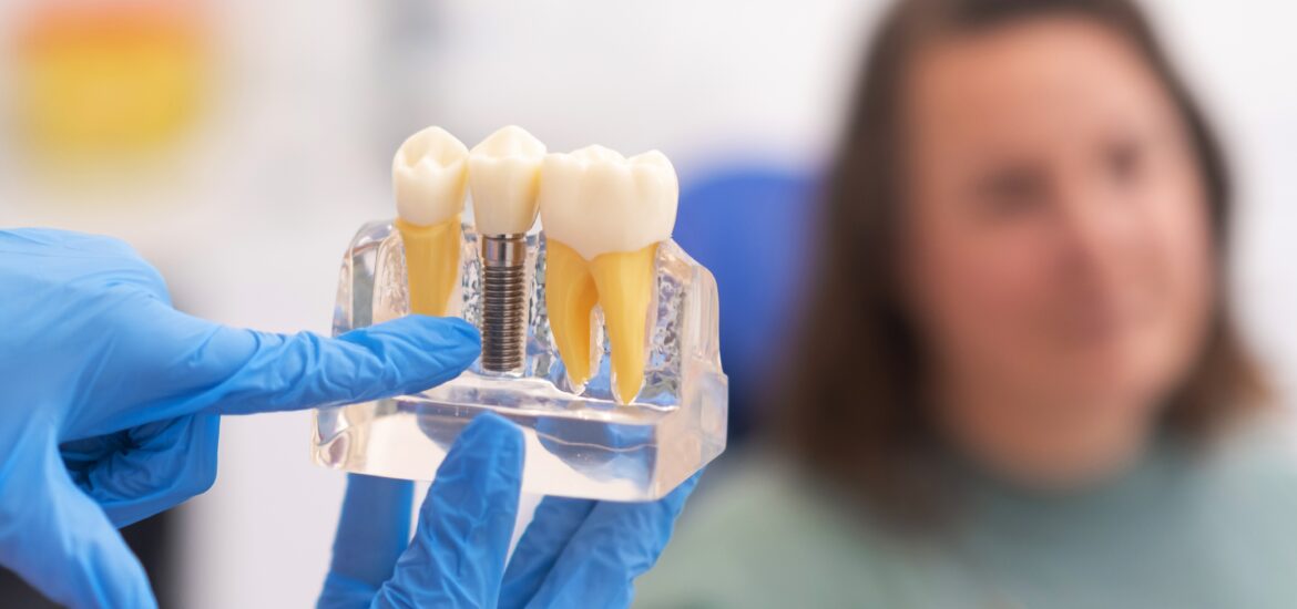 doctor in blue gloves showing a female patient a dental implant model